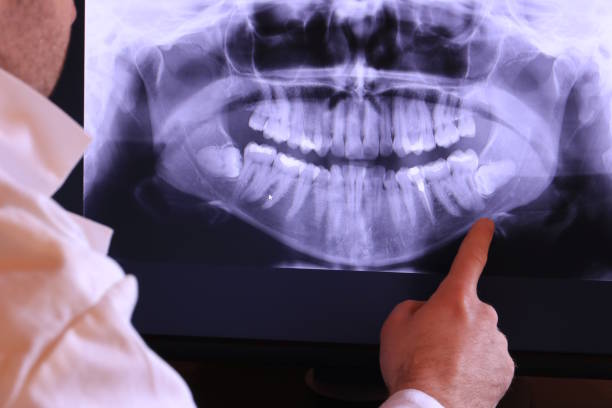 Best Urgent Care for Lost Fillings or Crowns in Davidson, NC