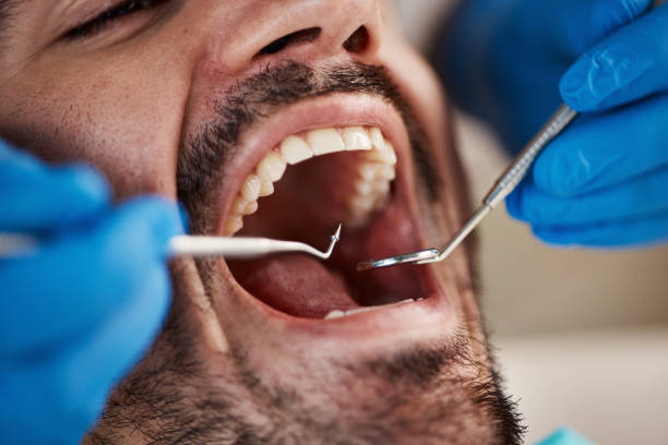 Best Emergency Denture Repair in Davidson, NC
