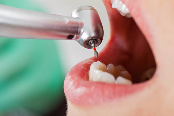 Best Weekend Emergency Dentist in Davidson, NC